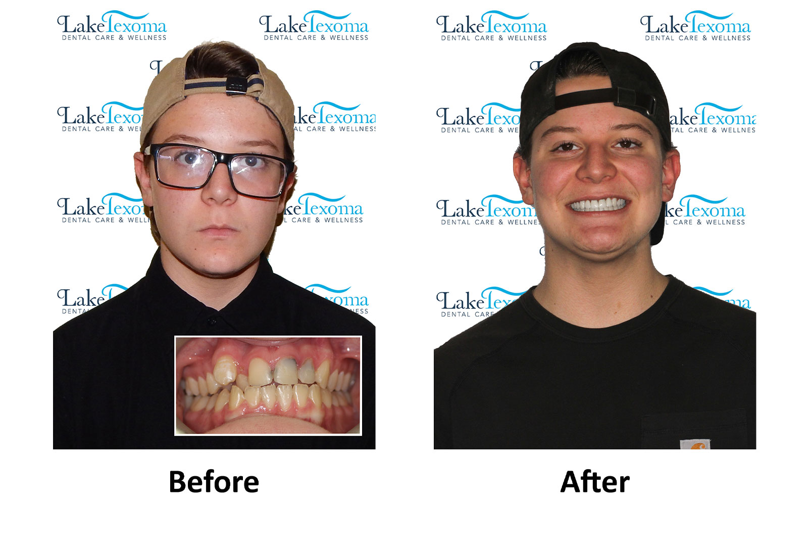 Headshot of patients before and after procedure