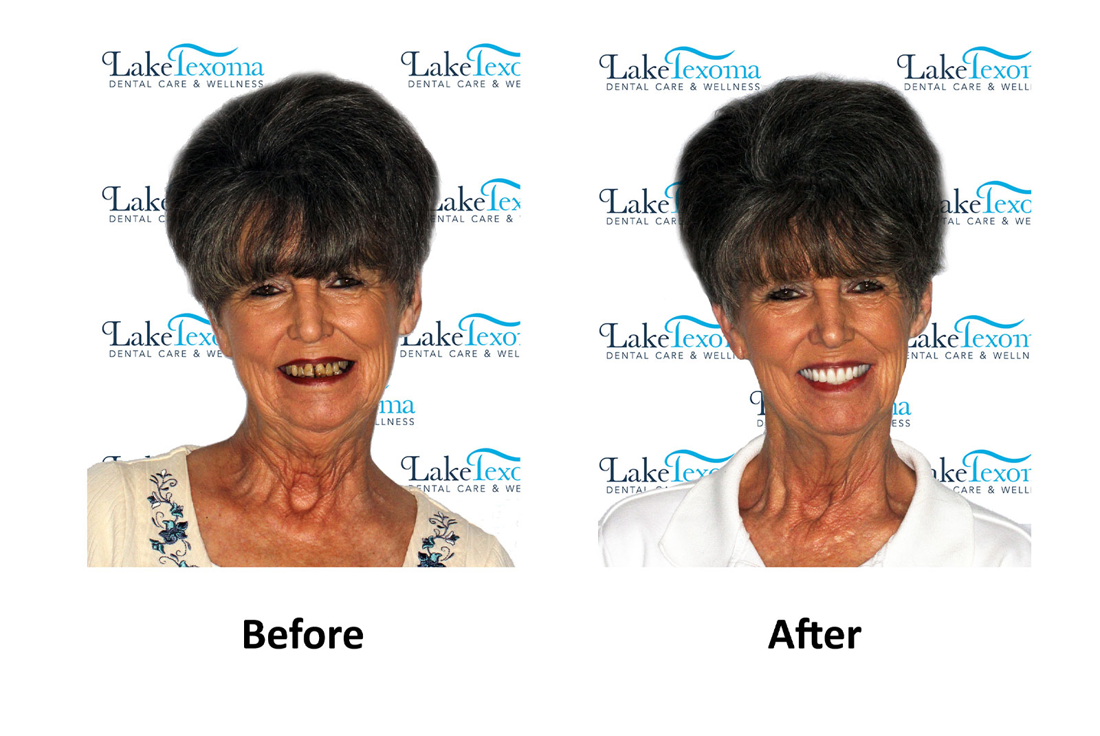 Headshot of patients before and after procedure