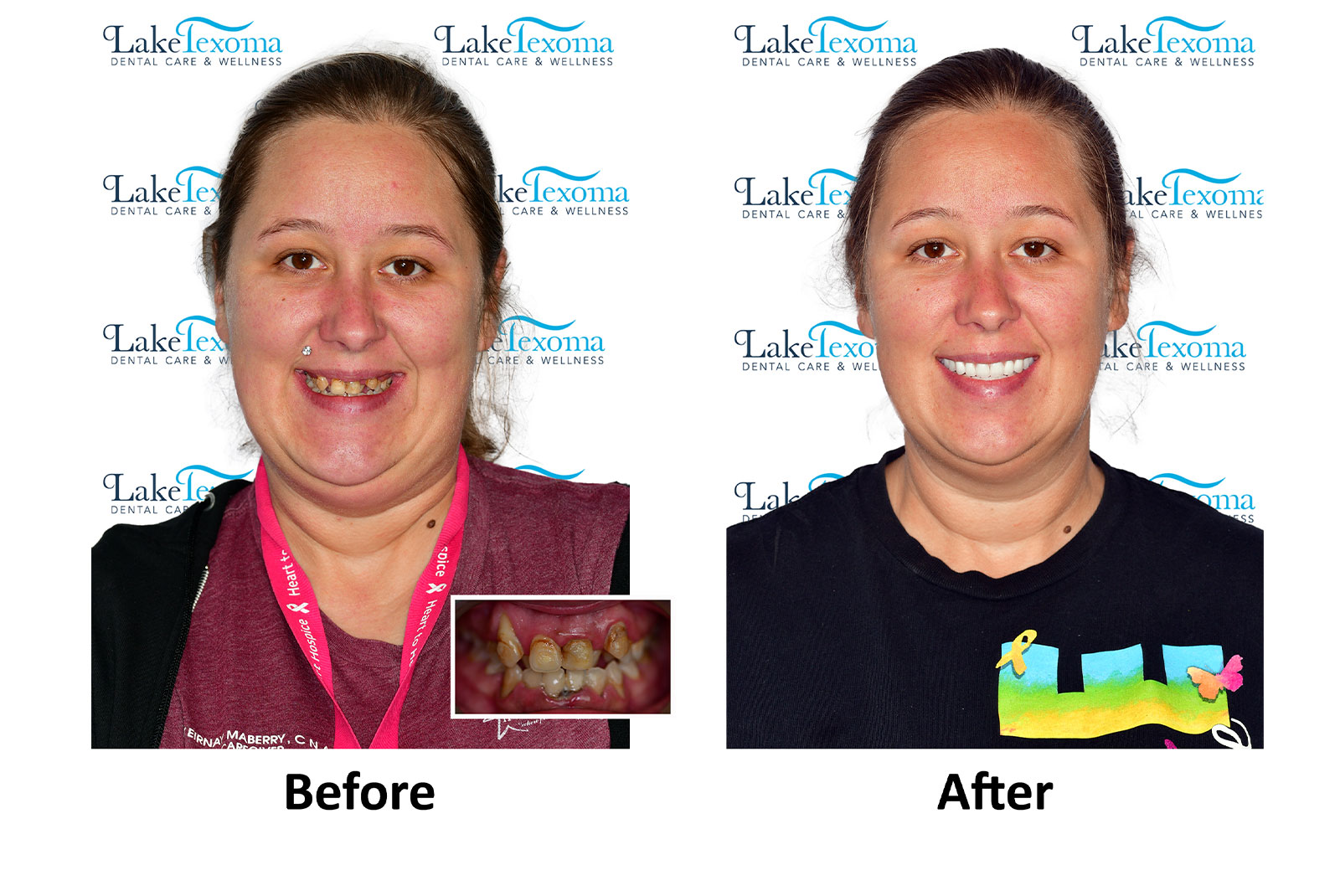 Headshot of patients before and after procedure
