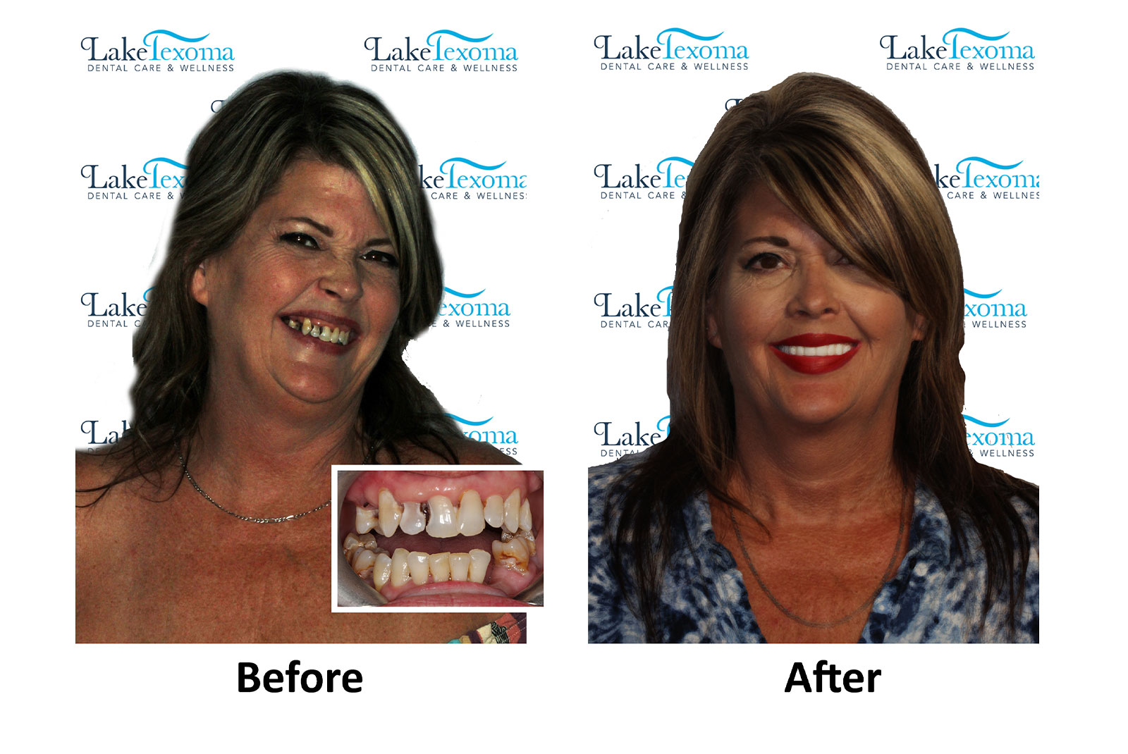 Headshot of patients before and after procedure