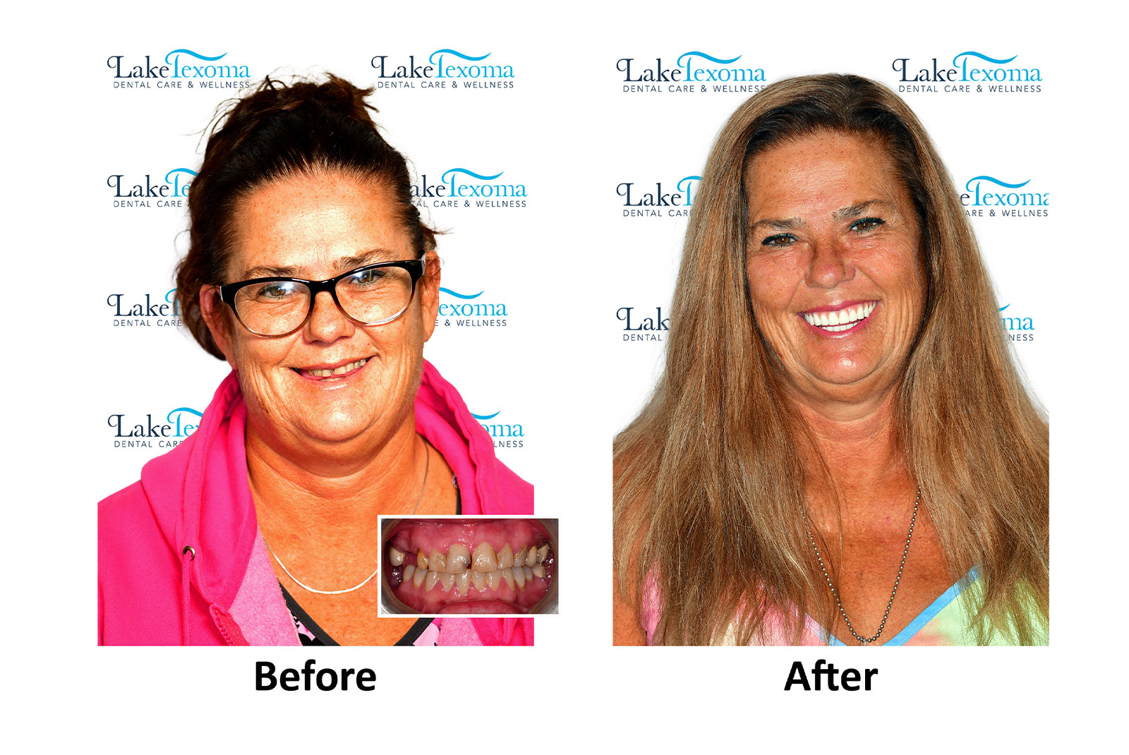 Headshot of patients before and after procedure