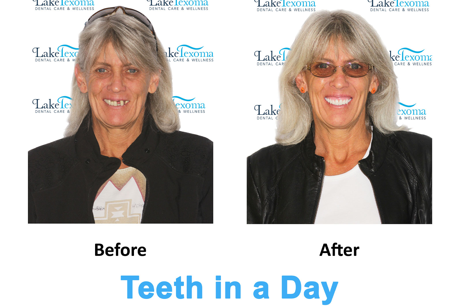 Headshot of patients before and after procedure