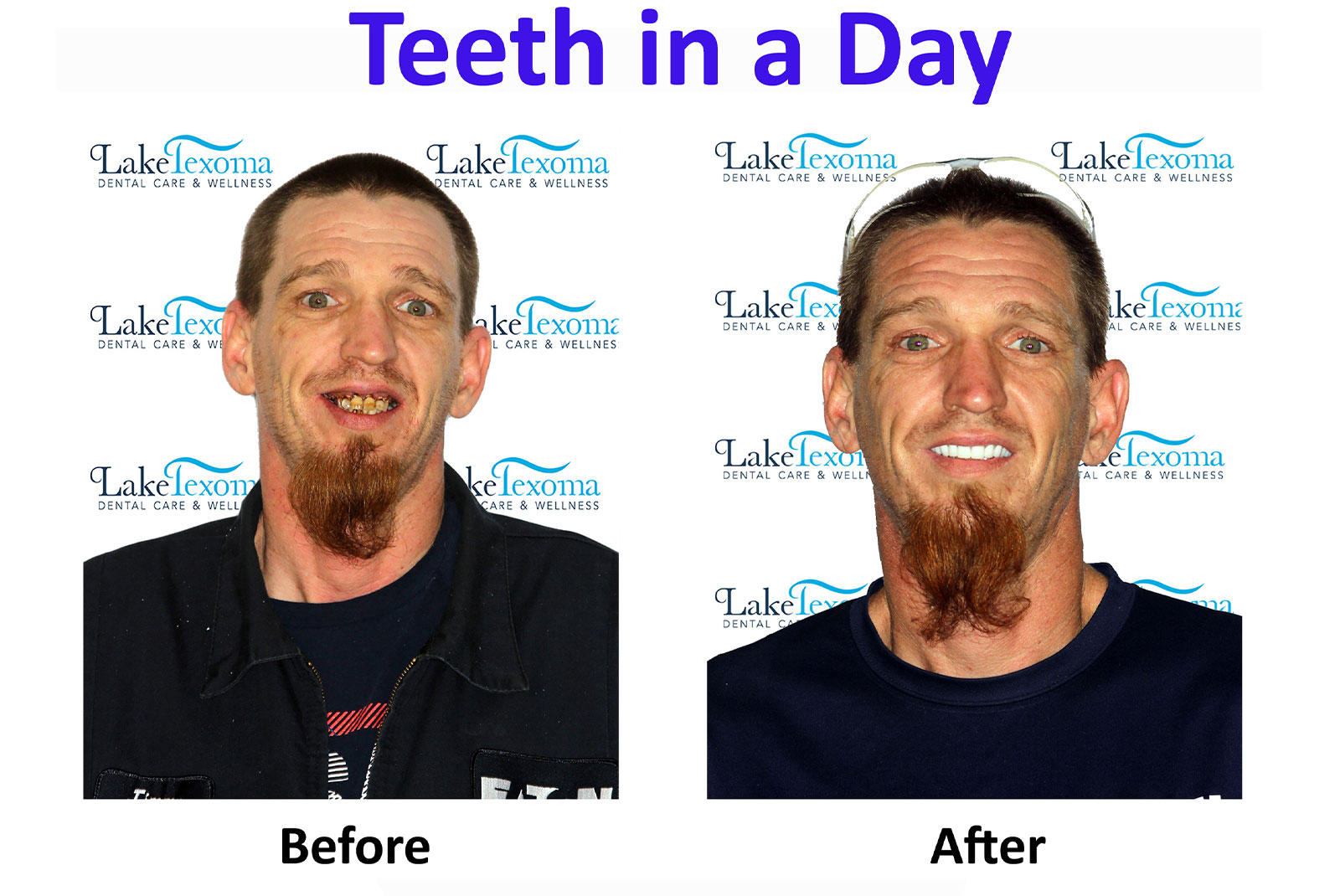 Headshot of patients before and after procedure