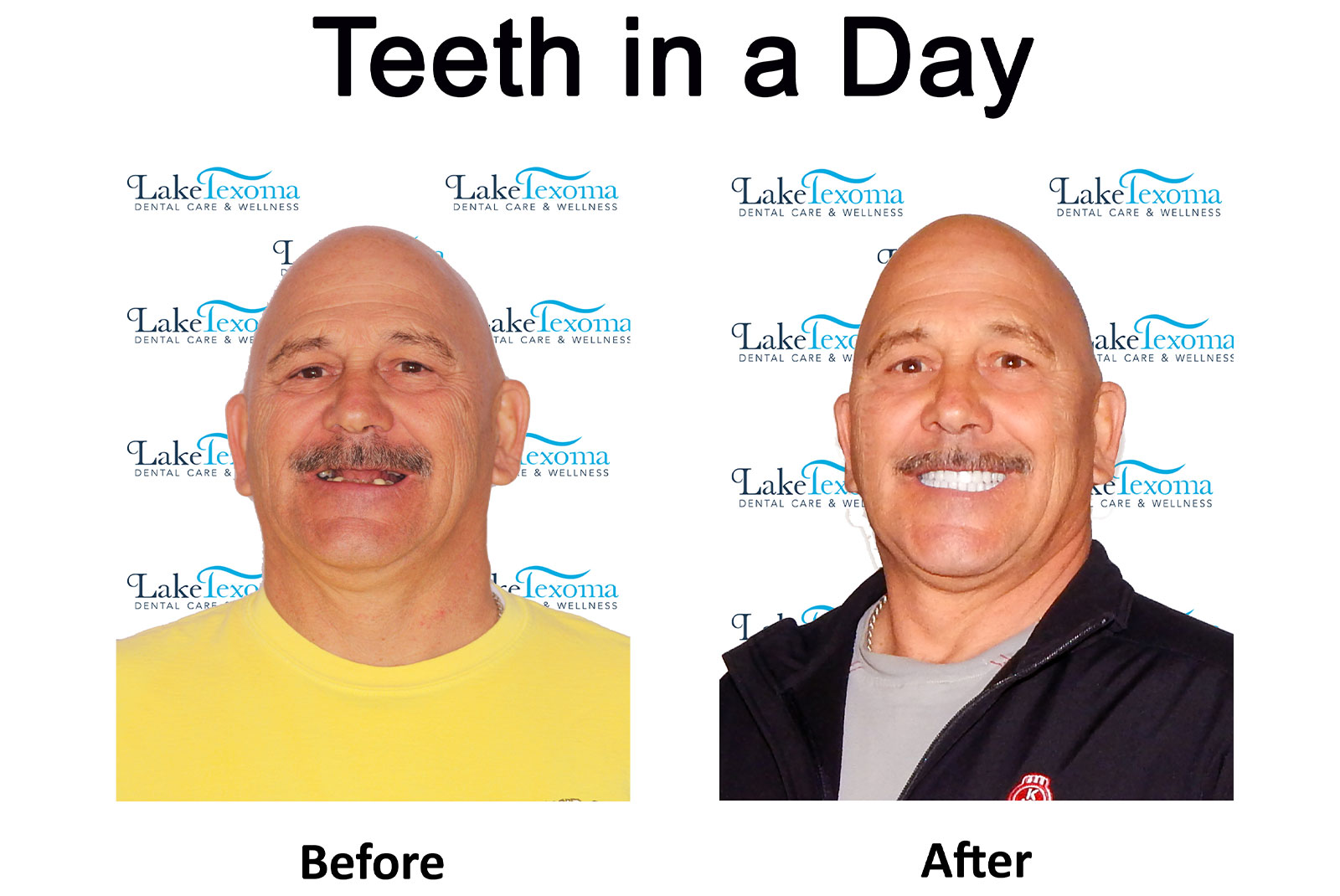 Headshot of patients before and after procedure