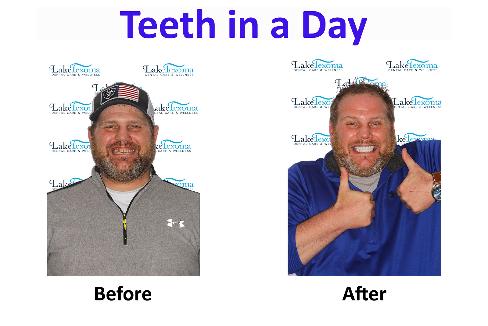 Headshot of patients before and after procedure