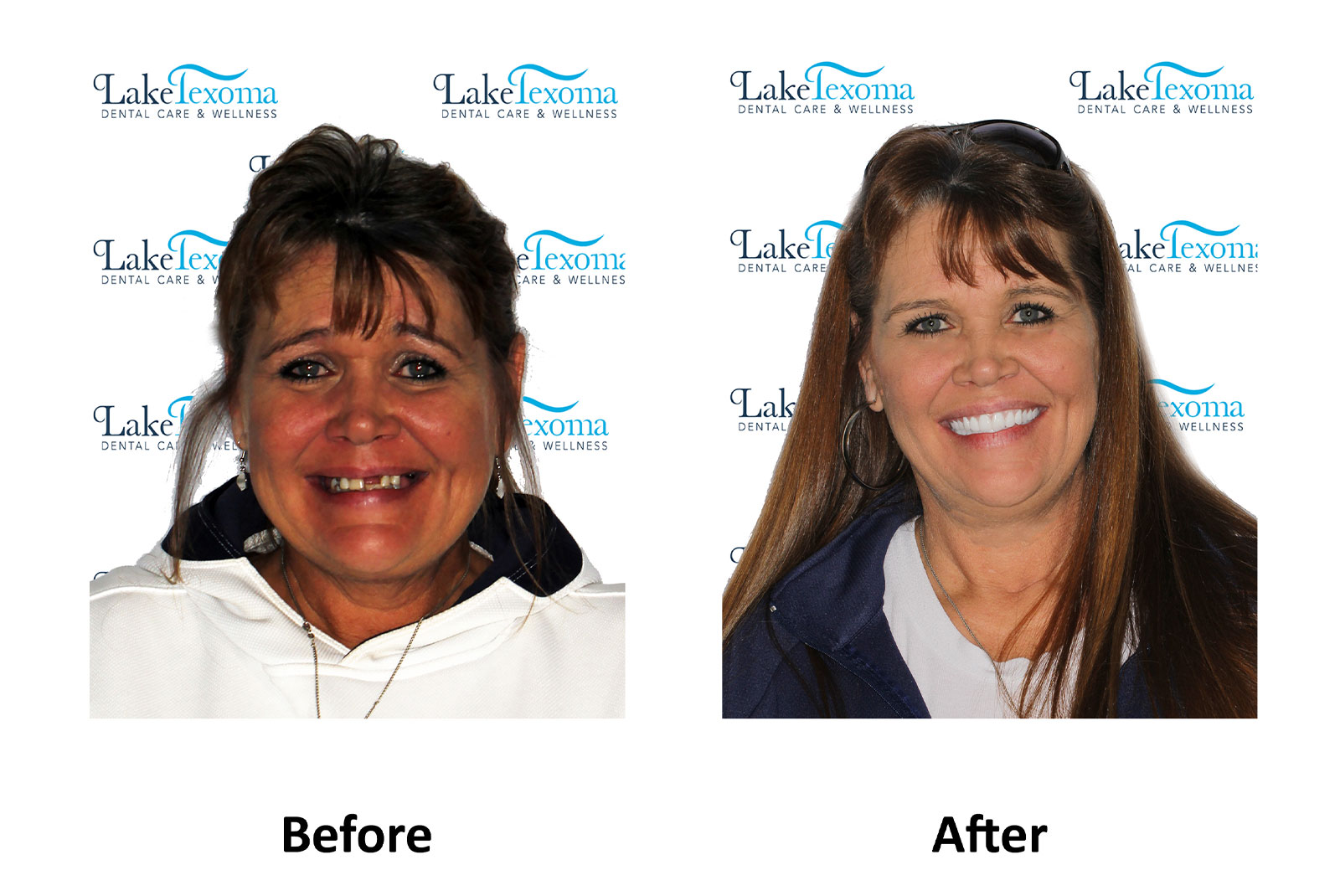 Headshot of patients before and after procedure