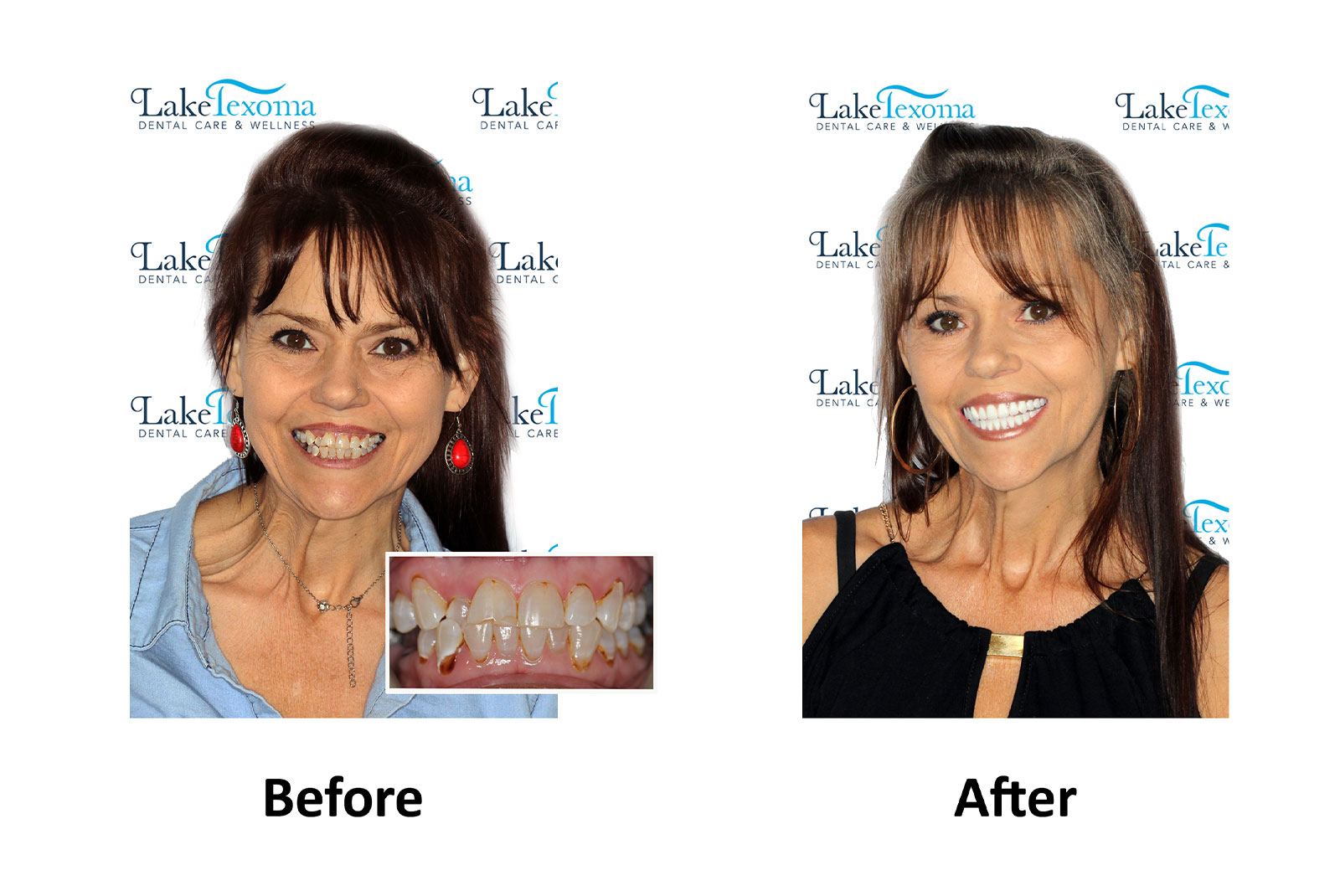 Headshot of patients before and after procedure