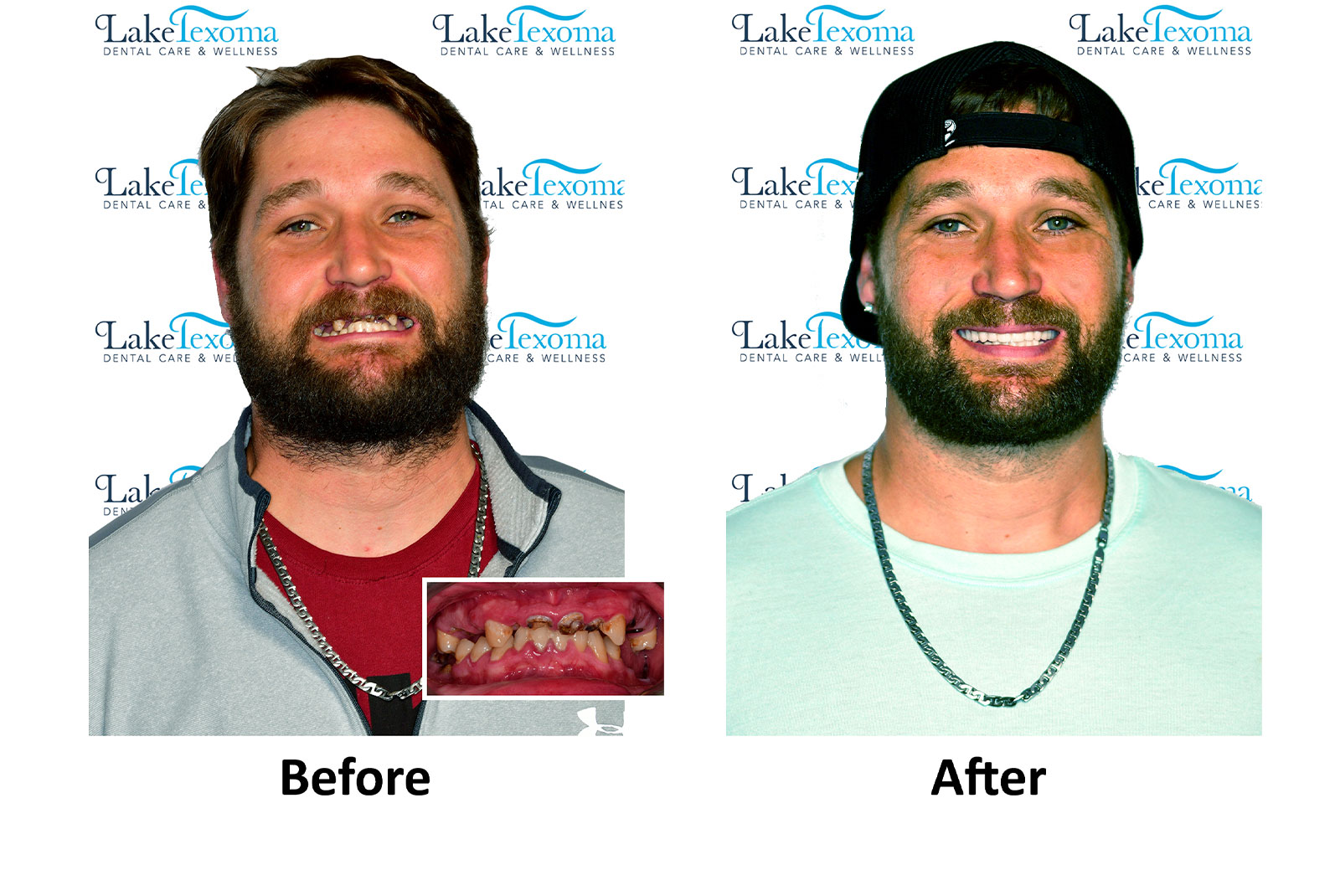 Headshot of patients before and after procedure