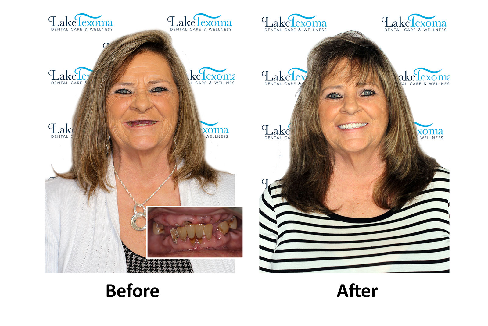 Headshot of patients before and after procedure