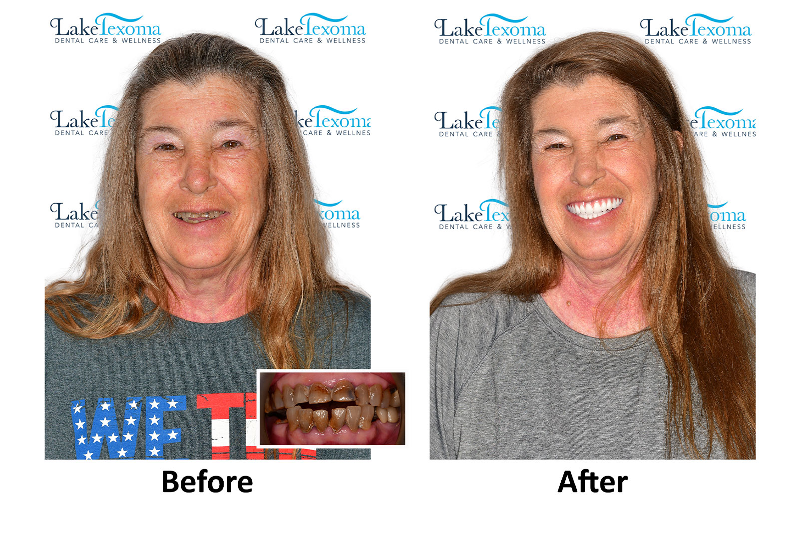 Headshot of patients before and after procedure