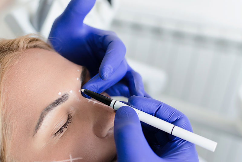 Doctor Preparing Patient for botox