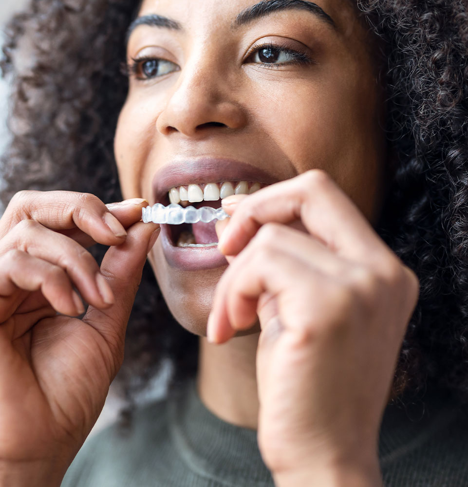 Patient putting a invisalign in her mouth