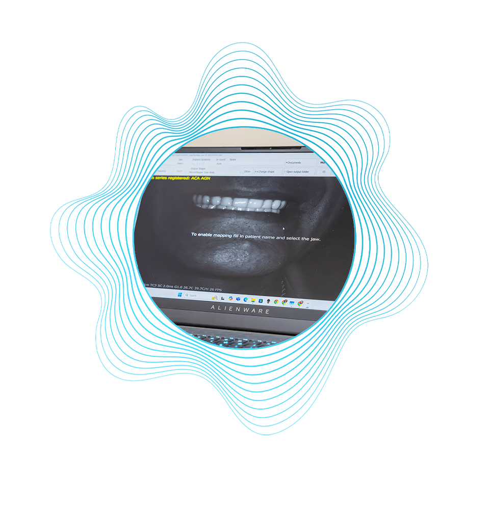 3d Scan of Patients teeth