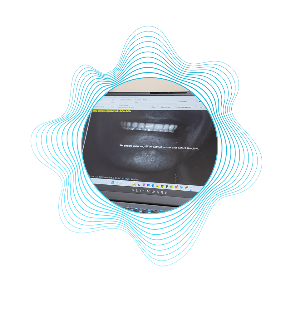 3d scan of Patient teeth
