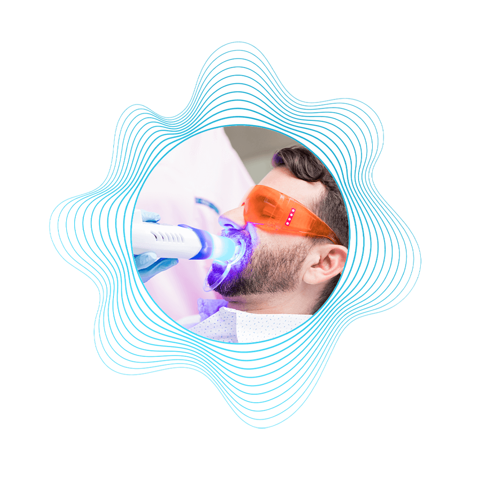 teeth whitening