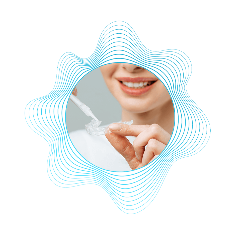 woman using teeth whitening gel